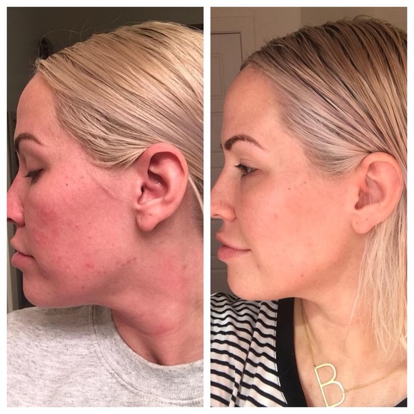 🌿BRAND NEW LUXURY SKINCARE🌿 - Picture 4 of 4